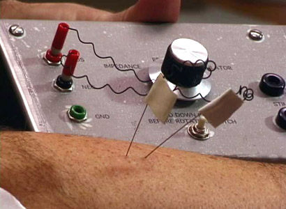 Équipment de microneurographie