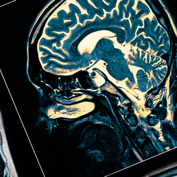 Image numérique d’un cerveau humain