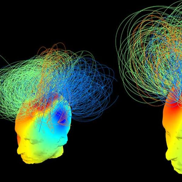 Three diagrams of human heads, generated from data, show areas of the brain lit up with different colours. A series of lines criss-cross above each head – connecting one area to another.