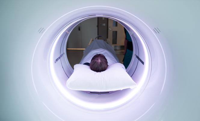 Le sommet de la tête d'une personne couchée sur le dos, vue à travers le cylindre d'un appareil d'imagerie médicale