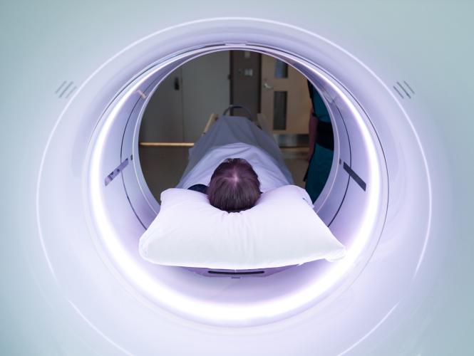 Le sommet de la tête d'une personne couchée sur le dos, vue à travers le cylindre d'un appareil d'imagerie médicale