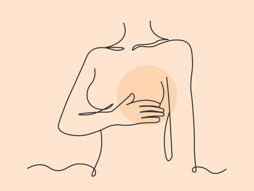 A stylized line drawing of a woman's torso with one breast highlighted by a coloured circle.