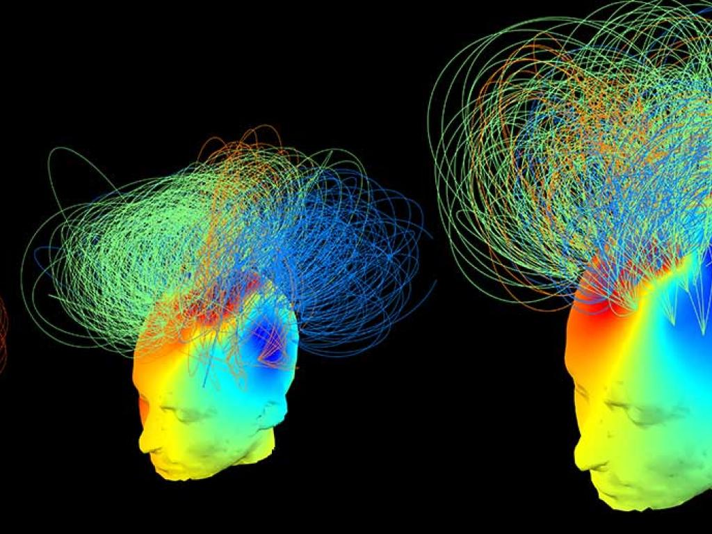 Three diagrams of human heads, generated from data, show areas of the brain lit up with different colours. A series of lines criss-cross above each head – connecting one area to another.