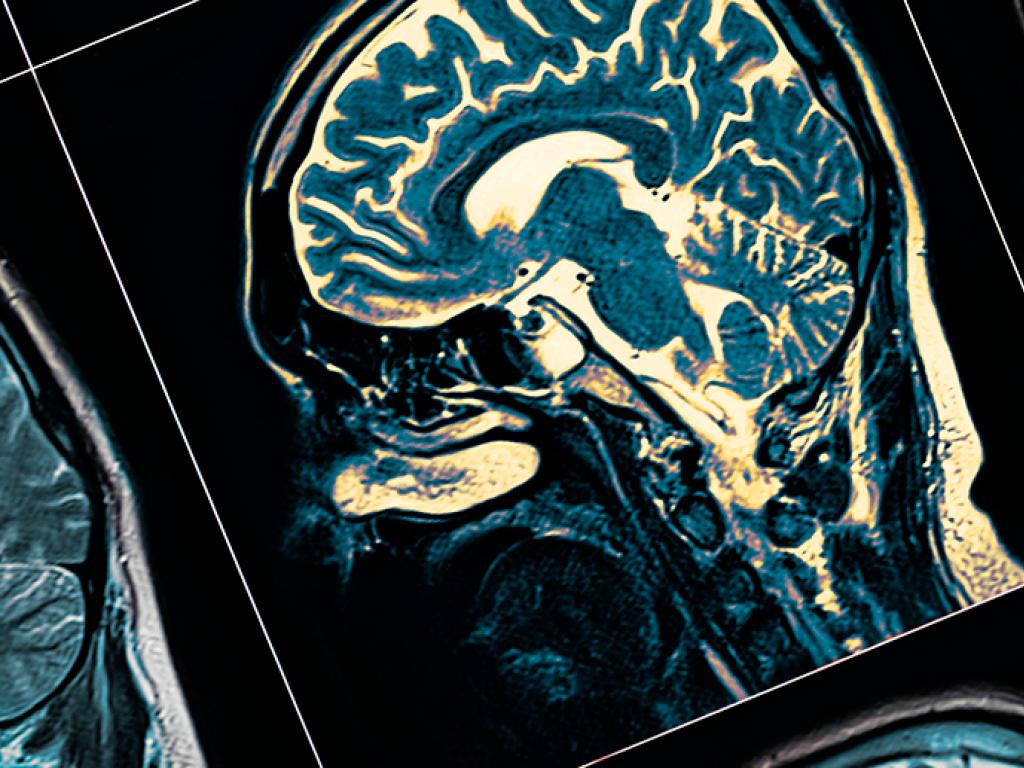 A digital scan of a human brain