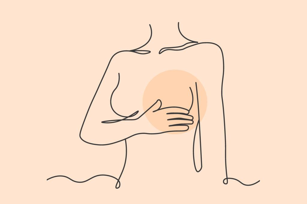 A stylized line drawing of a woman's torso with one breast highlighted by a coloured circle.