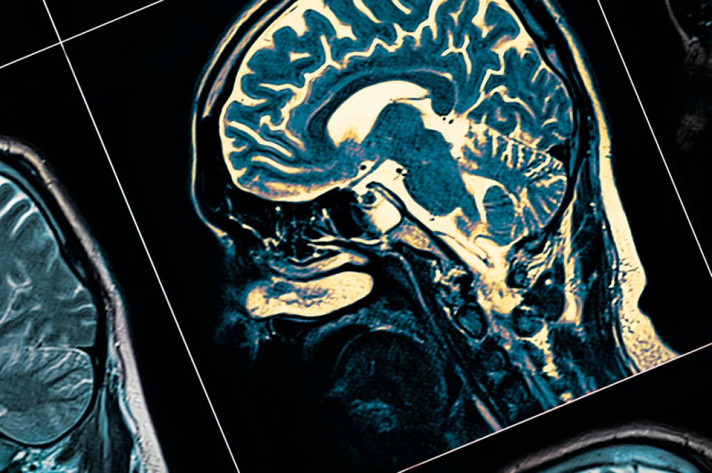 A digital scan of a human brain